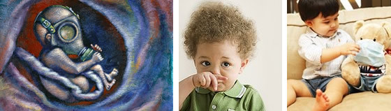 过敏性疾病 过敏性疾病